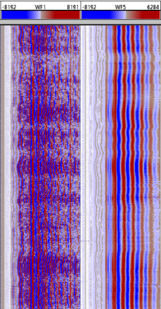 Acoustic imagers